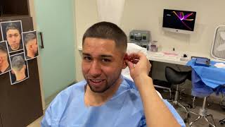 Ear Pinning Otoplasty A Patient Story Los Angeles  Dr Ardesh [upl. by Ardnasela]