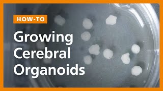 How to Grow Cerebral Organoids from Human Pluripotent Stem Cells [upl. by Hiller]