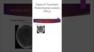 Types of Traumatic Parenchymal Lesions TPLs [upl. by Claudianus576]