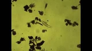 Bdelloidea Rotifer Philodina in motion [upl. by Eilyah]