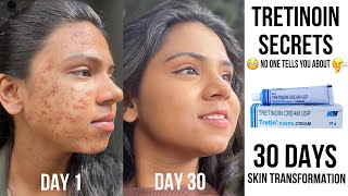 Tretinoin Secrets No one tells you about🤫🌸✨ My 30 days skin transformation using tretinoin [upl. by Yelrihs]