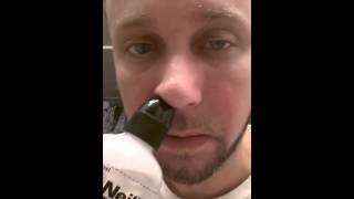 Septoplasty Day 6 Sinus Rinse Gross [upl. by Betthezul]