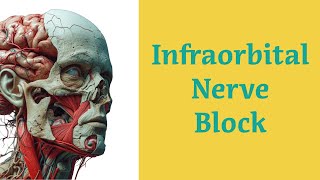 Infraorbital Nerve Block Procedure [upl. by Talie]