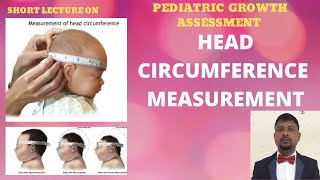 HEAD CIRCUMFERENCE MEASUREMENT PEDIATRIC GROWTH DEVELOPMENT ASSESSMENTHYDROCEPHALUS MICROCEPHALY [upl. by Doscher]