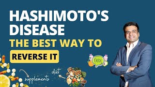 What is Hashimotos Disease Symptoms of Hashimotos  The Best way to Reverse Hashimotos Disease [upl. by Nylavad567]