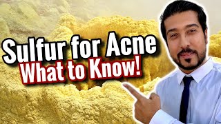 Sulfur for Acne Scars  How to Use Sulfur Soap Masks and Spot Treatment [upl. by Gannie]