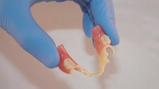 Bredent BioDentaplast Partial Dentures [upl. by Tumer]