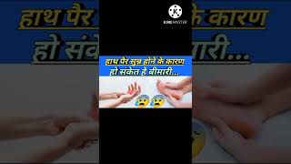 हाथ पैर सुन्न क्यो होते है  हाथ पैर सुन्न होने के कारण  handampfeet numbness [upl. by Irrot]