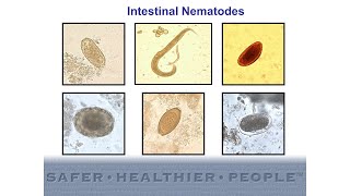 Diagnostic Features of Intestinal Nematodes [upl. by Ennyrb]