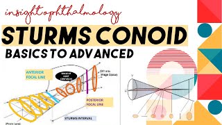 STURMS CONOID  APPLICATIONS AND CONCEPT  Types of astigmatism through sturms conoid [upl. by Brawner46]