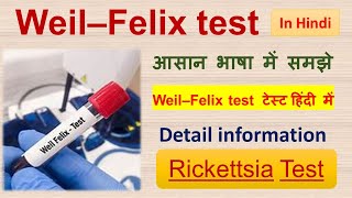 Weil–Felix test  Test for Rickettsia  Detail information in Hindi [upl. by Genisia]