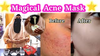 Magical Acne mask  100 results ⭐ BinteSaeed Kitchen and life [upl. by Sup]