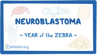 Neuroblastoma Year of the Zebra 2024 [upl. by Arutek]