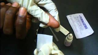 HIV Antibody Test Using a Rapidcard [upl. by Ahsaret463]