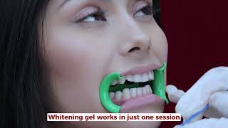 How do we do our teeth whitening [upl. by Lasiaf]