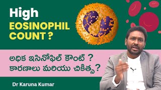 Reasons for High Eosinophil Counts  How to Reduce Eosinophils  Dr Karuna Kumar Hematologist [upl. by Pope]