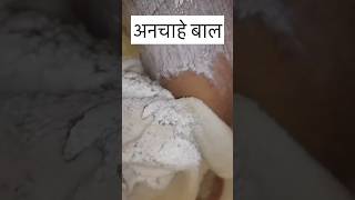 बिना Wax 1 दिन में हटाये अपने अनचाहे बाल Remove Unwanted Body Hair in 1 Day facialhair waxing [upl. by Suertemed]