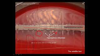 Satellitism test [upl. by Wellington]