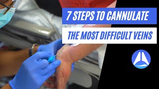 7 steps to cannulate the most difficult veins Live demonstration [upl. by Tocs929]