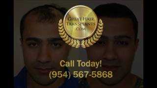 Dr Brett Bolton Patient Amir MaxHarvest™ Plus Hair Transplant [upl. by Rebeca]