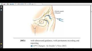 Musculoskeletal System  Arthrocentesis  Current Procedural Terminology [upl. by Dlorag818]