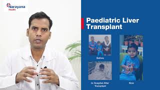 Liver Transplant in Childrenlivertransplant healthy doctor liverdoctor livercirrhosispatient [upl. by Ilegna883]