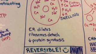 Ischemic Reperfusion Injury [upl. by Reuven]