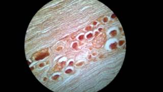 Histología del Sistema Nervioso [upl. by Anaahs132]