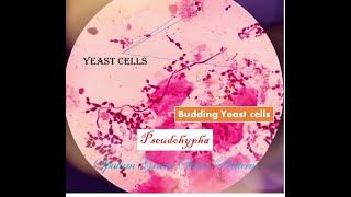 Yeast cell under microscope Sputum gram stain Yeast cells in sputum [upl. by Acinahs212]