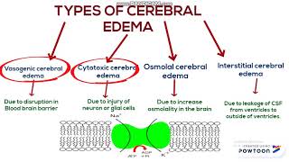 Cerebral edema [upl. by Nywles589]