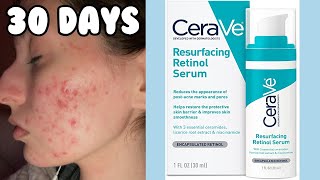 I TRIED THE CERAVE RESURFACING RETINOL SERUM FOR MY ACNE  1 Month Test [upl. by Moore]