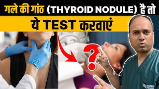 Thyroid Nodule के Diagnosis के लिए ये Tests कवाइए  Thyroid Nodule ke konse test karwaye [upl. by Noguchi]