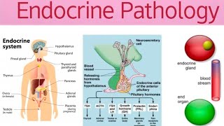 Endocrine Pathoma 2  Thyroid Gland amp Hyperthyroidism [upl. by Vihs968]