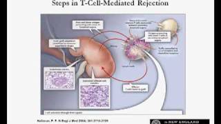 Immunosuppressive Drugs for Kidney Transplantation [upl. by Acisej]