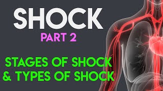 Stages of Shock  Types of Shock  Shock Part 2 [upl. by Gertruda]