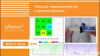 Pressure measurement on a wound retractor [upl. by Dobrinsky]