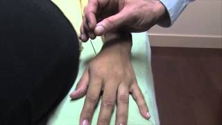 How To Manipulate an Acupuncture Needle  Oriental Medicine with Dr Justin Newman [upl. by Ettebab874]