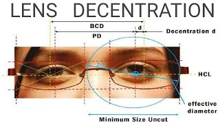 Lens Decentration  AK Khurana  Dr Saud Javed [upl. by Ettenwahs]