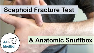 Scaphoid Fracture Test Clinical Exam and the Anatomic Snuffbox [upl. by Hickey393]