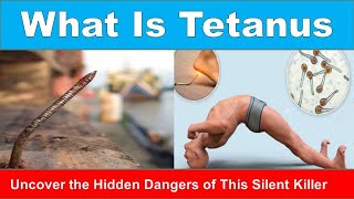 Tetanus Rusty Nails and Locked Jaws The History and Science of Tetanus Explained [upl. by Navoj109]