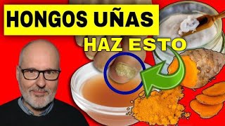 CÓMO ELIMINAR los HONGOS de las UÑAS [upl. by Sonaj346]