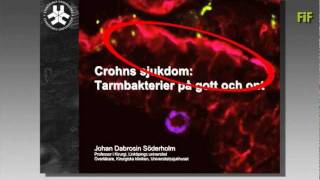 Crohns sjukdom  tarmbakterier på gott och ont [upl. by Garate]