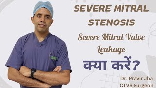 Severe MS  Severe MR  Severe Mitral Regurgitation  Severe Mitral Stenosis  Dr Pravir Jha [upl. by Wolsky872]