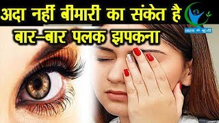 मुश्किल का संकेत हो सकता है बारबार पलक झपकना जानें इसके बारें में Reason for Eye Blink [upl. by Erastus]