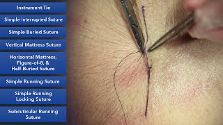 Learn How To Suture  Best Suture Techniques and Training [upl. by Ori]