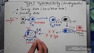 Type 1 hypersensitivity hindi [upl. by Attirb]