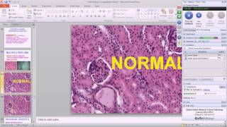 Medical School Pathology 2013 Season Session 19 Renal II [upl. by Prud]