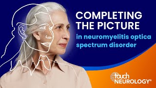 Considering the complete picture in neuromyelitis optica spectrum disorder [upl. by Bedad874]