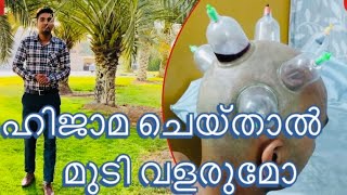 Hijama amp hair malayalam ഹിജാമ മലയാളം [upl. by Pennebaker685]