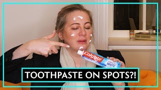 Dr Debunks Does Toothpaste Get Rid Of Spots [upl. by Mahda]